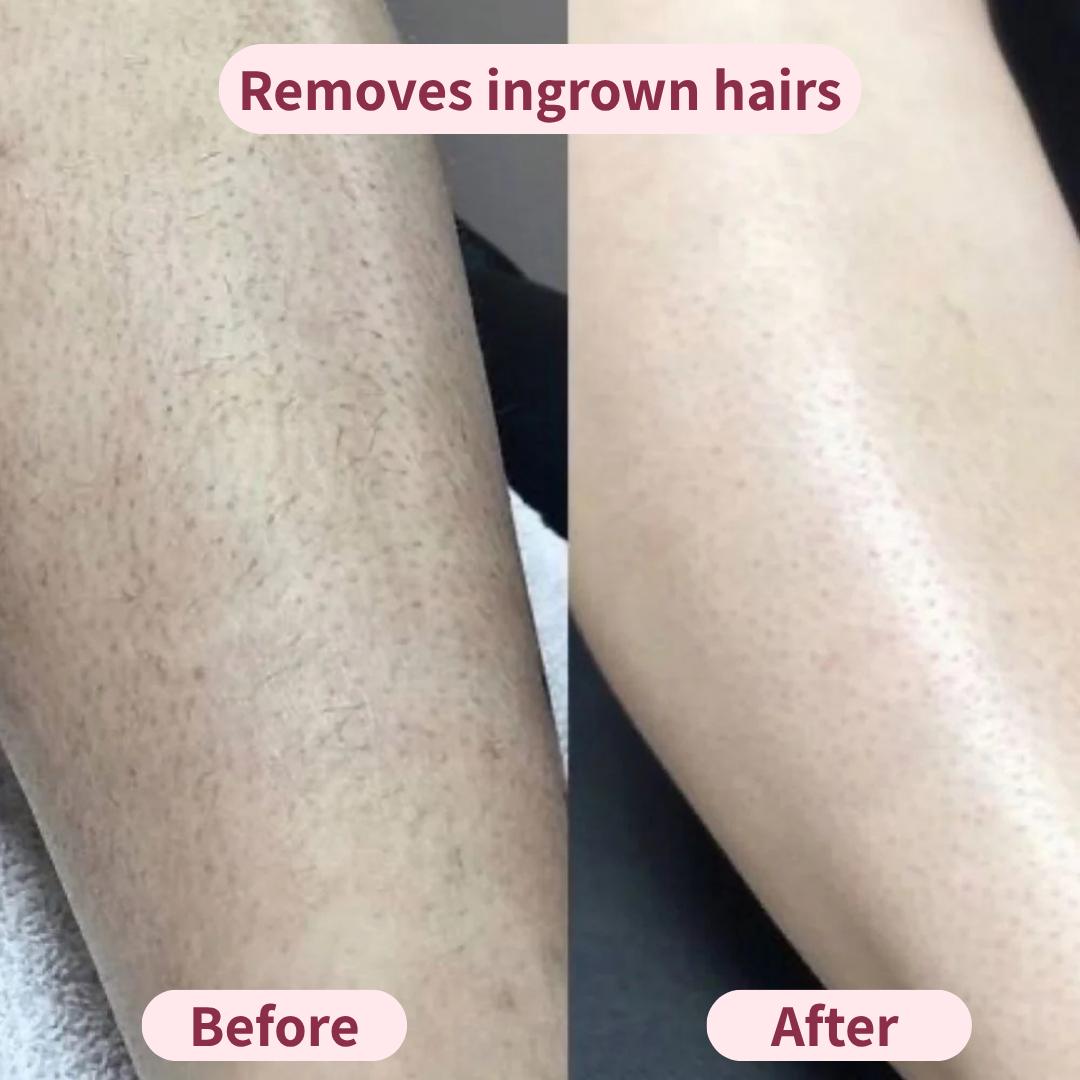 The smoother remover