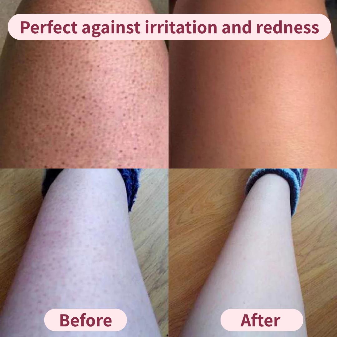 The smoother remover