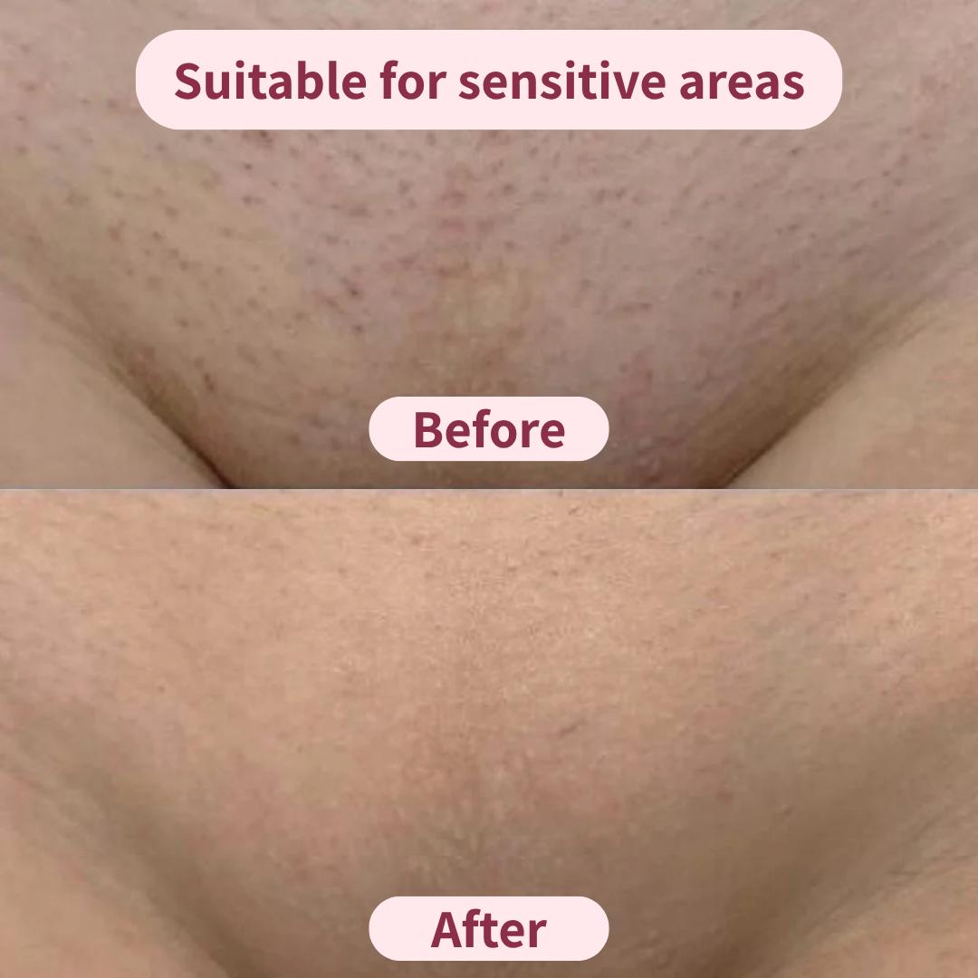 The smoother remover